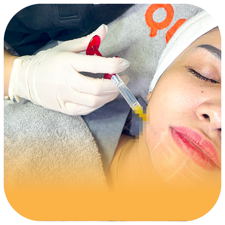 Menuanya usia kulit memunculkan kerutan di wajah. Kerutan ini bisa membuat Anda jadi tidak percaya diri. Namun, Anda tidak perlu khawatir karena ada banyak cara untuk menghilangkan kerutan di wajah